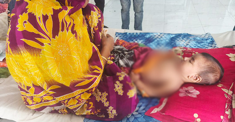 মাদারীপুরে হাম আক্রান্ত শিশুর সংখ্যা বাড়ছে