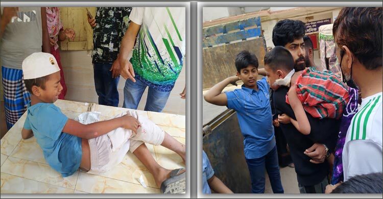 কুমিল্লায় পাগলা কুকুরের কামড়ে পাঁচ শিশু আহত