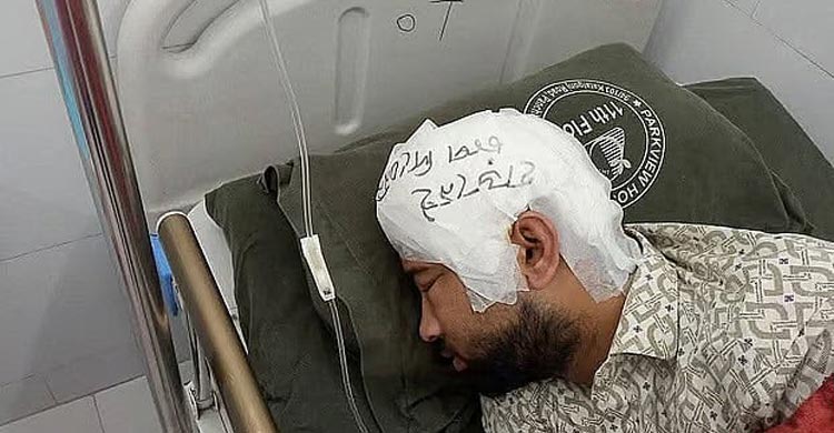 ২ মাস পর মামুনের মাথায় খুলি প্রতিস্থাপন