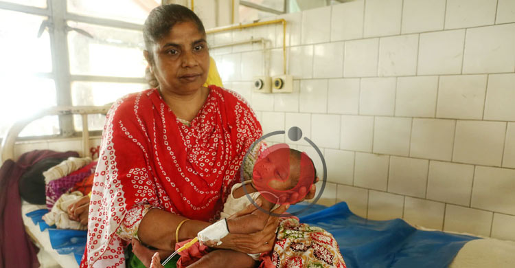 হাম নিয়ে আতঙ্ক নয়, সচেতনতা জরুরি