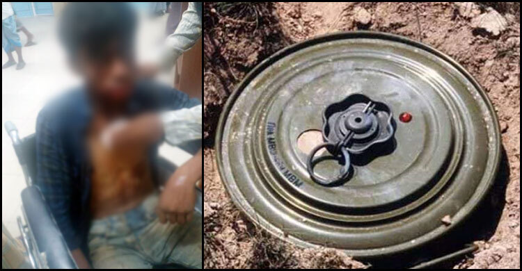 নাইক্ষ্যংছড়ি সীমান্তে মাইন বিস্ফোরণে ৩ বাংলাদেশি আহত