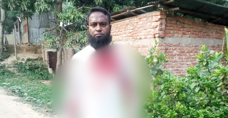 জামায়াতের প্রতিবাদ সভায় সন্ত্রাসী হামলা, দুজন গুলিবিদ্ধসহ আহত ১২