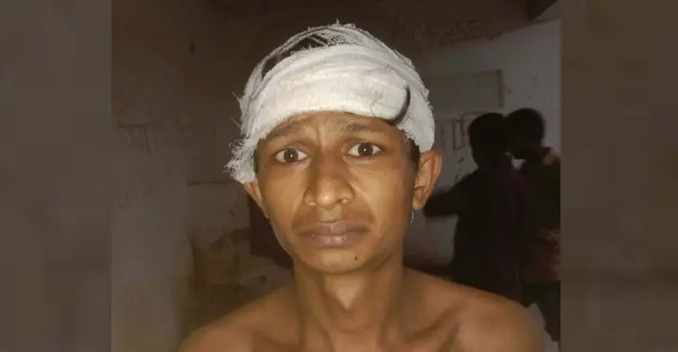মাদকবিরোধী অভিযানে মাথা ফাটলো, দায় নিচ্ছেন না এমপি-পুলিশ