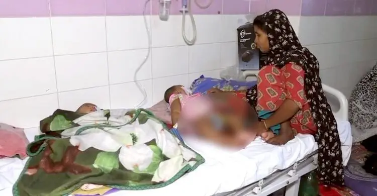 হামের উপসর্গ নিয়ে মমেক হাসপাতালে শিশুর মৃত্যু, একদিনে ভর্তি ৪১