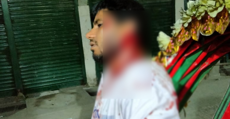 রূপগঞ্জে সাংবাদিককে কুপিয়ে জখম