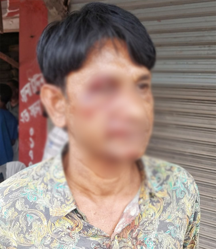 নারায়ণগঞ্জে স্থানীয় দুই সাংবাদিকের ওপর হামলা