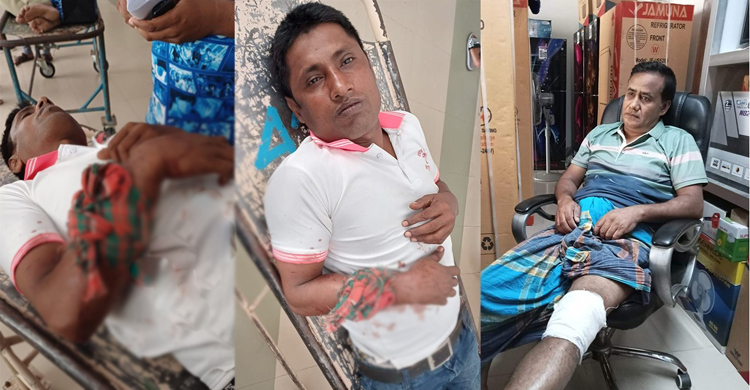 নেতাকর্মীদের ওপর হামলা, ইউপি চেয়ারম্যানসহ আহত ১৫