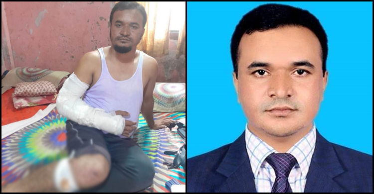 এবার দুর্গাপুরে সাংবাদিককে হাতুড়িপেটার অভিযোগে মামলা