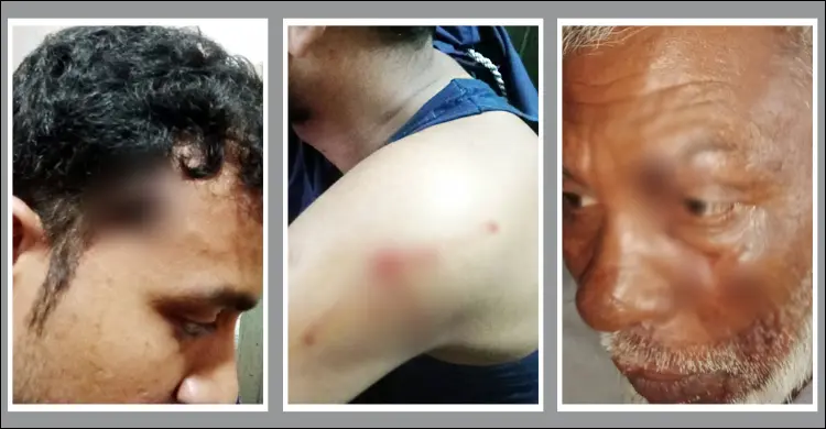 টহল পুলিশের ওপর গুলি: ফাঁড়ি ইনচার্জসহ আহত ৫