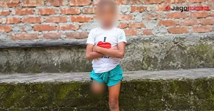 পা হারিয়ে ঘরে ফেরা রায়হান/ছবি: জাগো নিউজ