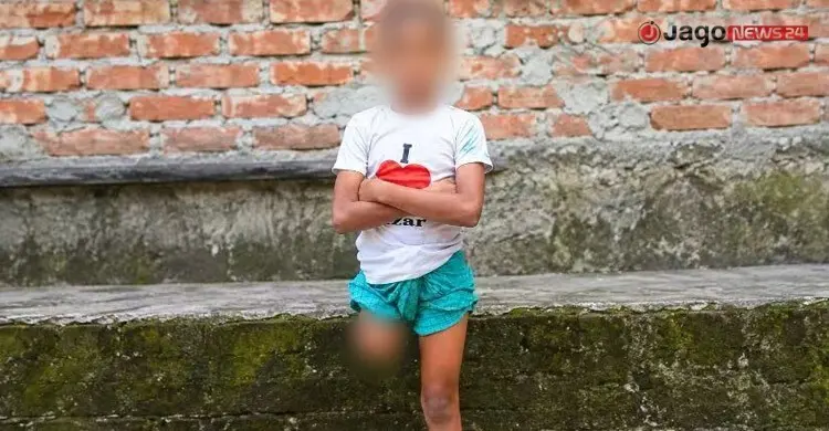অবুঝ রায়হানের পা কেটে বানানো হয় ‘ভিক্ষার মেশিন’