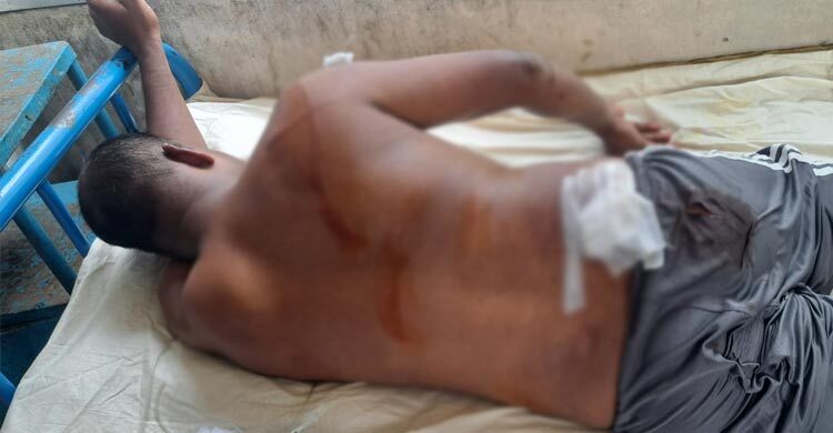 রাজবাড়ীতে চাঁদা না পেয়ে প্যানেল চেয়ারম্যানকে কুপিয়ে জখম