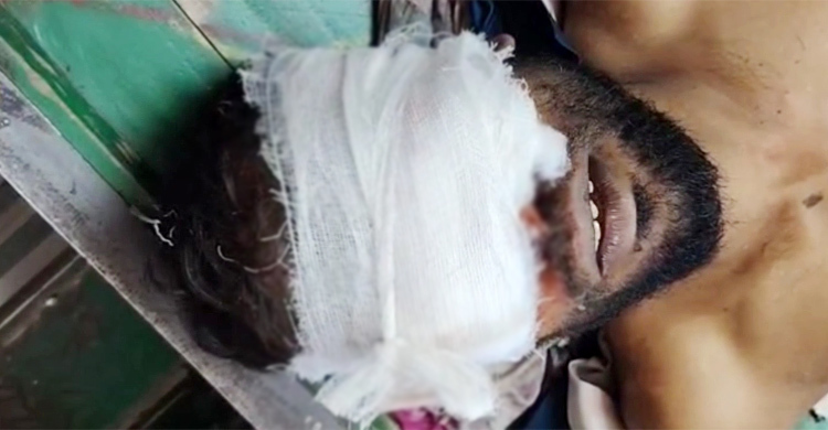 উপড়ে ফেলা হলো অটোরিকশাচালকের চোখ, চার হাত-পায়ের রগ কর্তন