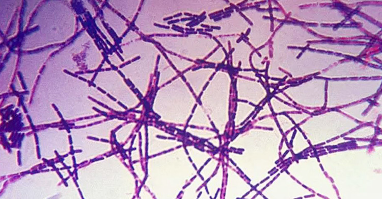 এবার রংপুরের আরেক উপজেলায় অ্যানথ্রাক্স উপসর্গের ৬ রোগী