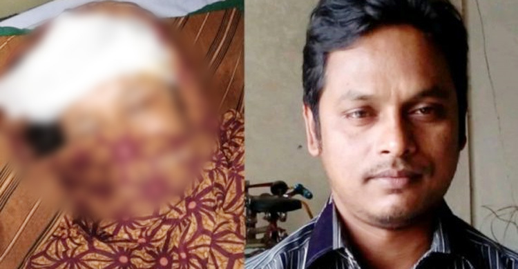শাশুড়ির মাথা ফাটিয়ে জামাই ‘ইচ্ছা করে মারিনি’