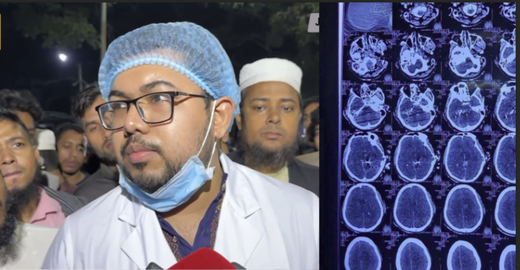 হাদির মাথার একপাশে গুলি ঢুকে অন্য পাশ দিয়ে বের হয়েছে: চিকিৎসক