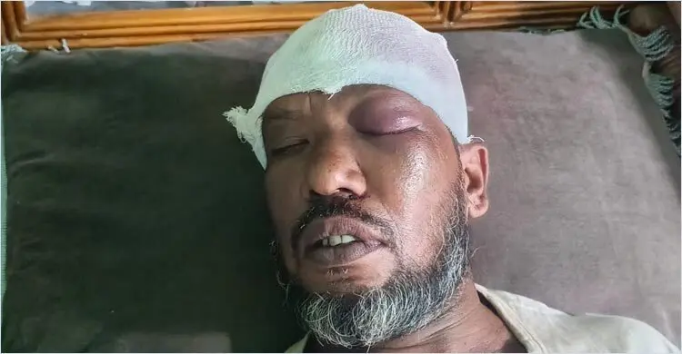 পরকীয়ায় বাধা দেওয়ায় কৃষকের মাথা থেঁতলে দিল যুবক