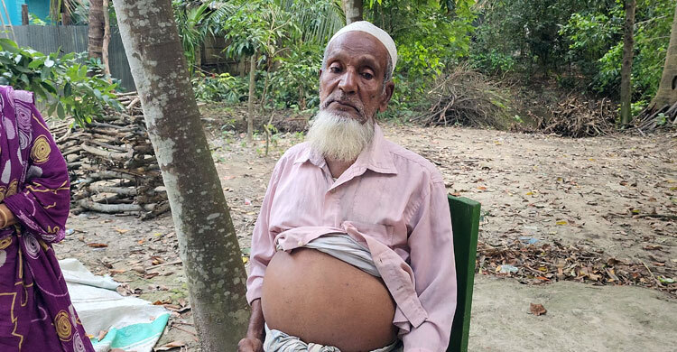 লিভার সিরোসিসে আক্রান্ত ভ্যানচালক শাহালমের কণ্ঠে বাঁচার আকুতি