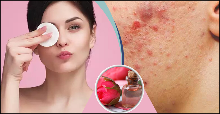রূপচর্চায় গোলাপ জলের সঙ্গে যে উপাদান মেশাবেন না