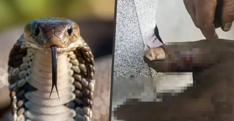 সাপের বিষ মুখে টেনে স্বামীকে বাঁচাতে গিয়ে নিজেই হাসপাতালে নারী