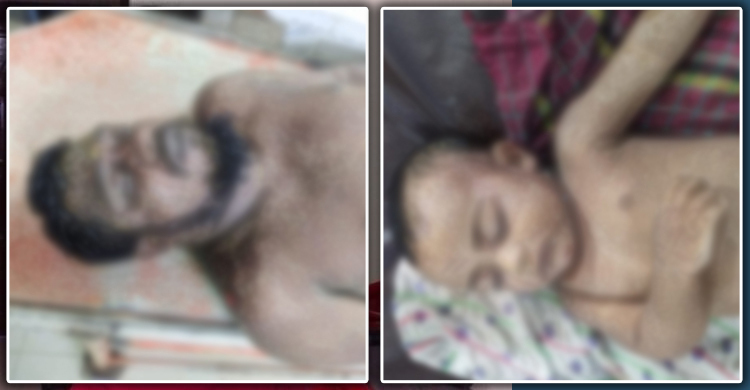 Father, daughter killed in landslide in Ctg