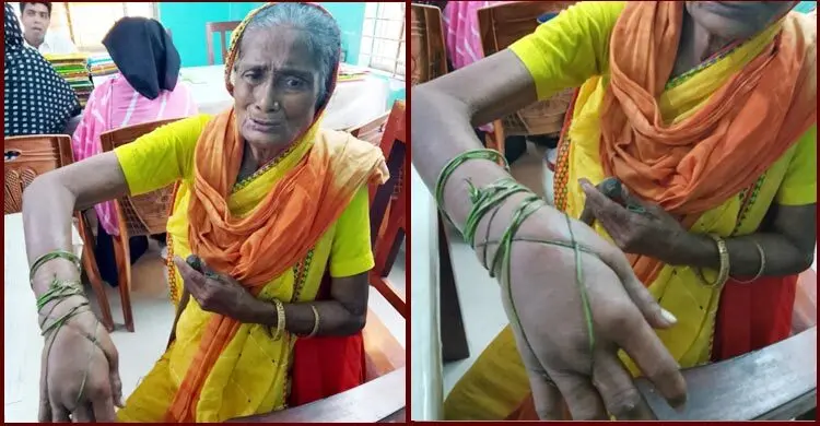 হাত ভেঙে বিনাচিকিৎসায় কাতরাচ্ছেন কাঙালিনী সুফিয়া, চাইলেন সাহায্য