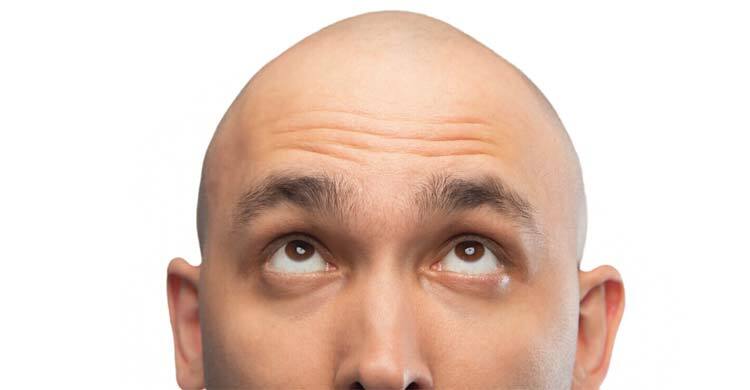 সিরাম কি পারবে ২০ দিনে চুল গজাতে যা বলছেন গবেষকরা