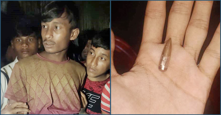 সীমান্তের ওপারে গোলাগুলি, এপারে গুলিবিদ্ধ রোহিঙ্গা যুবক