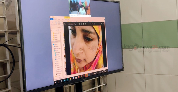 টেলিমেডিসিন সেন্টার চালাবেন নার্সরা, বাদ পড়ছেন পুরোনো কর্মীরা