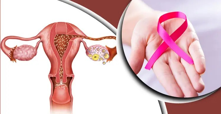 প্রাথমিক পর্যায়ে শনাক্ত করুন জরায়ুমুখ ক্যানসার, রক্ষা করুন জীবন