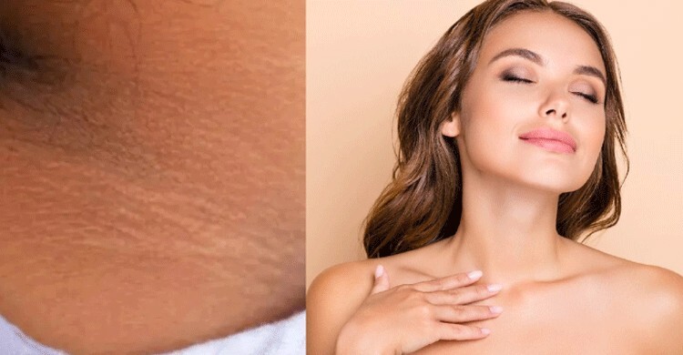 ঘাড় কপালের কালো দাগ তুলতে ভরসা রাখুন ঘরোয়া প্যাকে