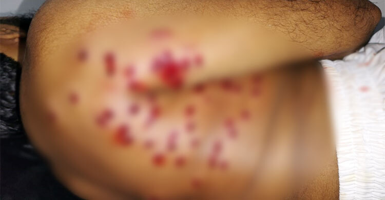 নোয়াখালীতে অধ্যক্ষ গুলিবিদ্ধ, মোটরসাইকেল ছিনতাইয়ের চেষ্টা