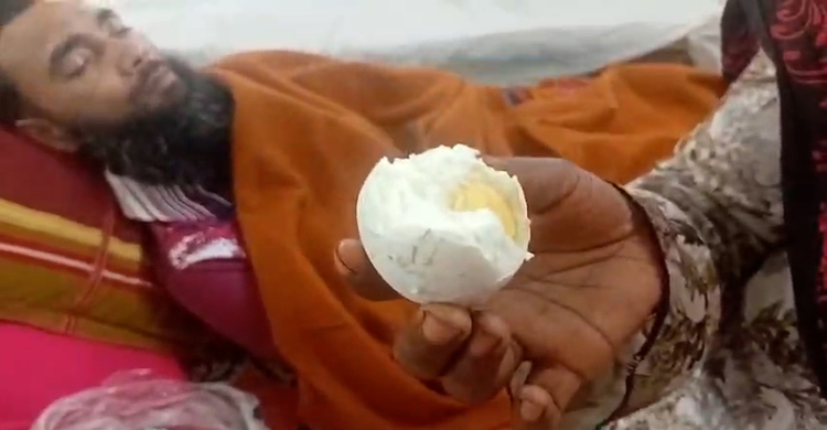 হাসপাতালে রোগীদের খাবারে পচা ডিম, পাউরুটিতে ছত্রাক