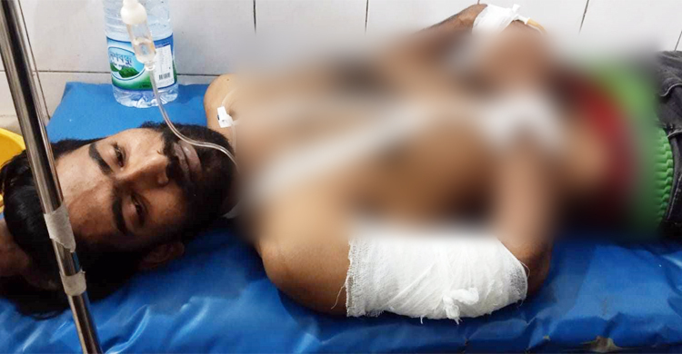 Two Nagad employees shot, Tk 60 lakh snatched