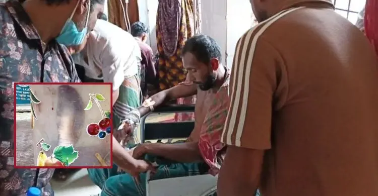 কামড় খেয়ে জ্যান্ত সাপ নিয়ে হাসপাতালে হাজির কৃষক
