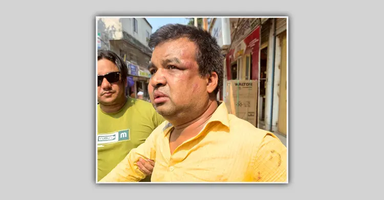 ভ্যাট পরিদর্শককে পিটিয়ে খুঁটির সঙ্গে বেঁধে রাখলো ব্যবসায়ী