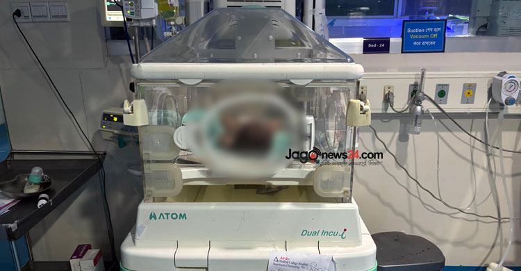 ইনফেকশনের কারণেও অনেক শিশু অকালে জন্ম নেয়