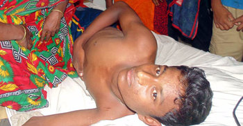 মাদক সেবনের প্রতিবাদ করায় কিশোরকে নির্যাতন