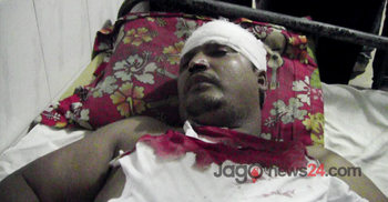 মাদারীপুরে যুবলীগ নেতাকে কুপিয়ে জখম