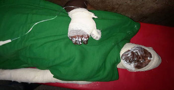 ফেনীতে পেট্রল বোমা হামলায় চালক দগ্ধ