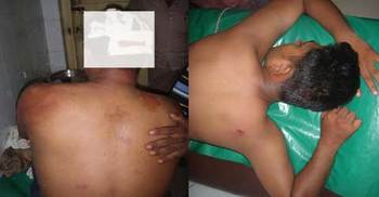 আসামি ধরতে গিয়ে ৪ পুলিশ আহত