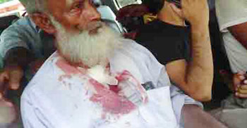 জাফরউল্লাহর পথসভায় গুলি, ওসিসহ আহত ৭