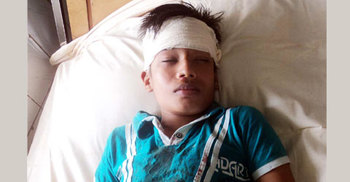 পিরোজপুরে শিক্ষার্থীর মাথায় পড়লো শ্রেণি কক্ষের ফ্যান