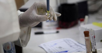 Zika virus infection `through sex` reported in US