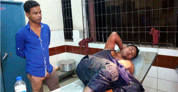 ব্রাহ্মণবাড়িয়ায় পুলিশের গাড়িতে গুলির ঘটনায় মামলা দায়ের