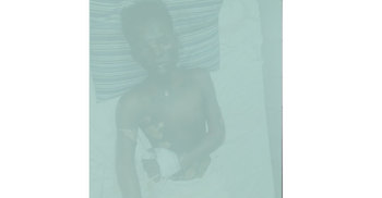 মাদক সেবনে বাধা দেয়ায় অটোচালককে পুড়িয়ে দিলো দুর্বৃত্তরা 