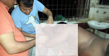ব্রাহ্মণবাড়িয়ায় যুবককে কুপিয়ে হত্যার চেষ্টা