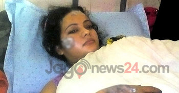 স্বামীর দেয়া অ্যাসিডে ঝলসে গেল কলেজছাত্রীর মুখমণ্ডল