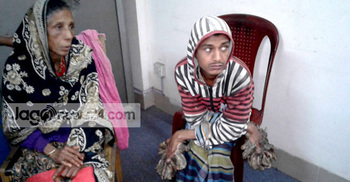 বৃক্ষমানবের দুই আঙ্গুলে সফল অস্ত্রোপচার