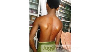 শিক্ষকের এলোপাতাড়ি বেত্রাঘাতে ২০ শিক্ষার্থী আহত